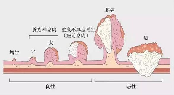 中医药在直肠癌综合治疗中的作用