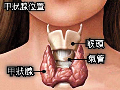 甲状腺癌